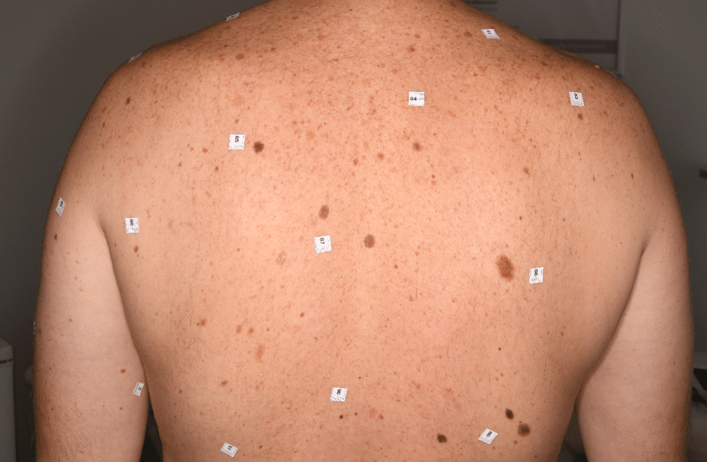 Fekete Gabor 1978 04 04 in situ mm kesoi regresszioval reg