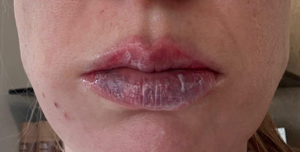 bad aesthetic clinic experience